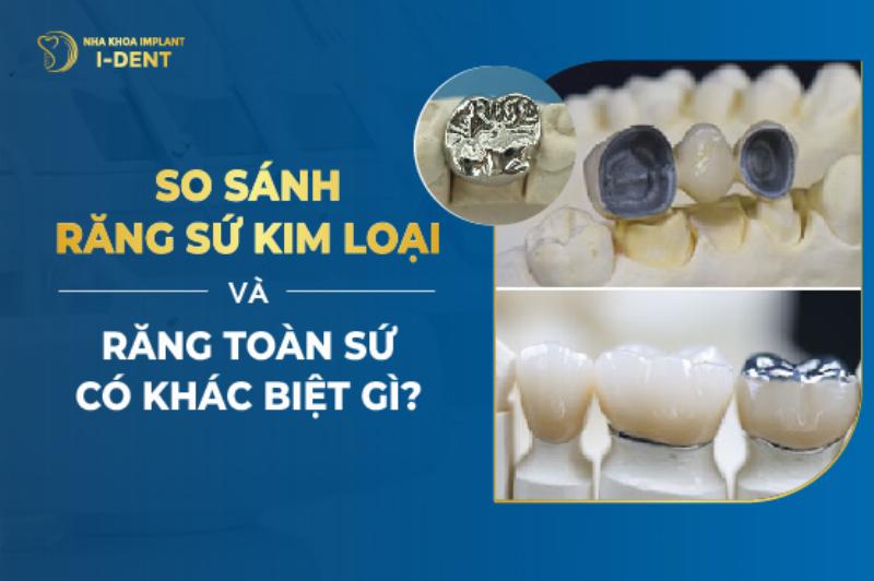 So sánh đam mỹ ngược với thể loại khác